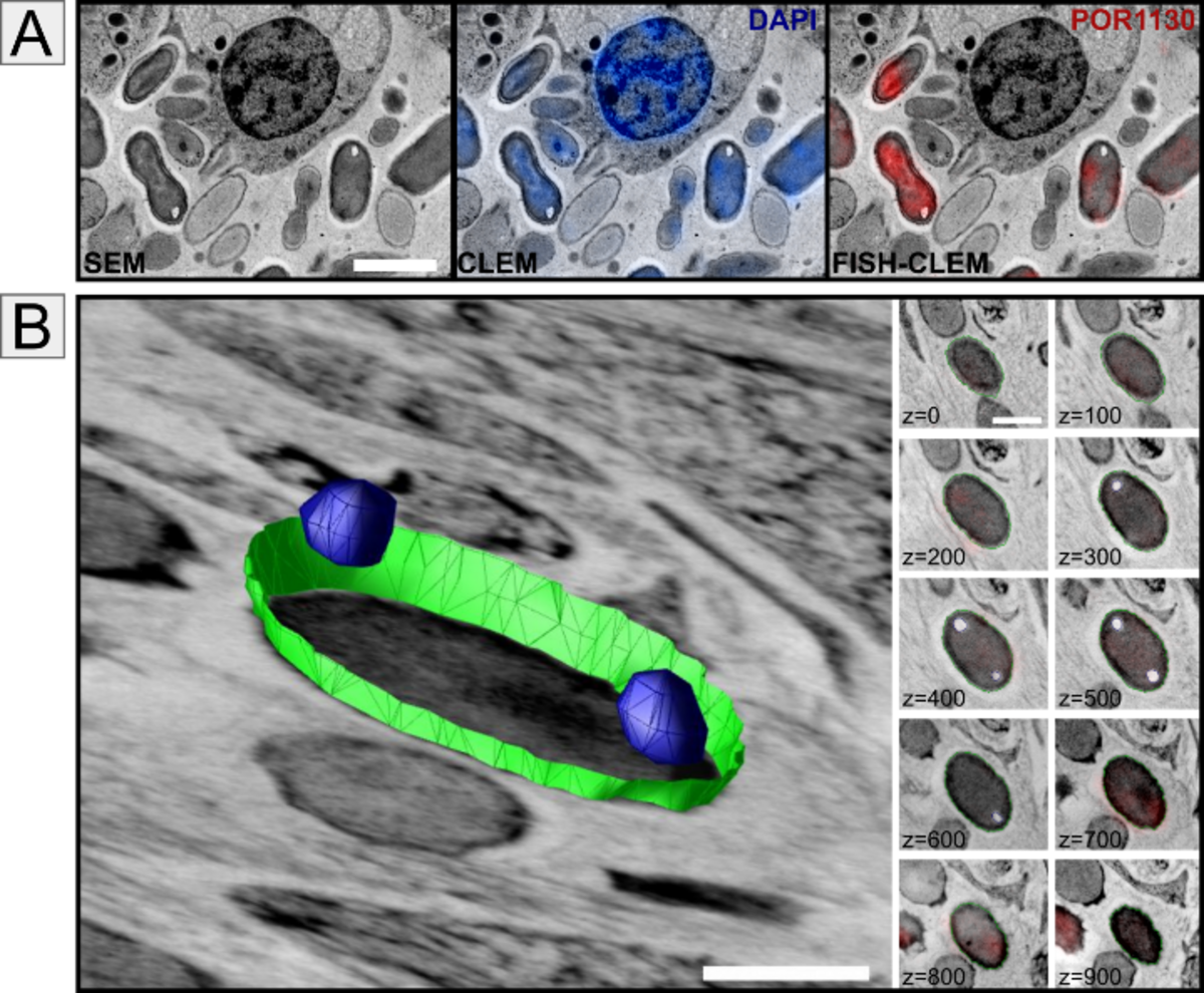 3D reconstruction of a Poribacterium inside the marine sponge by FISH-CLEM.