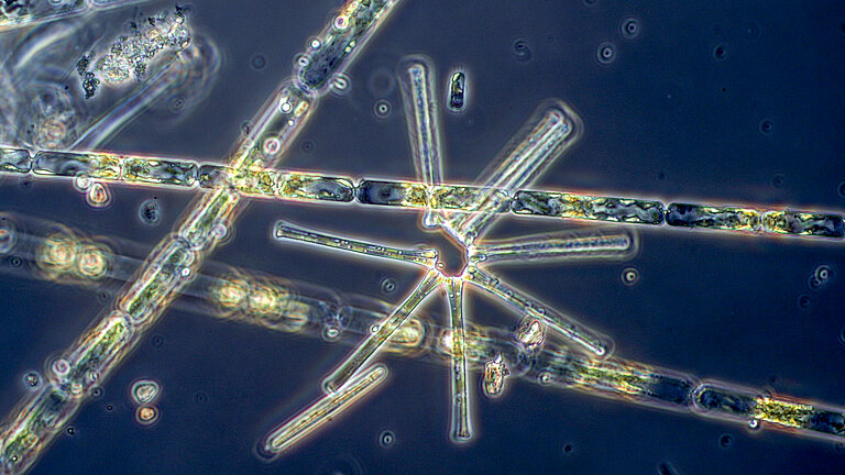 Mikroskopische Aufnahme von Phytoplankton - mikroskopisch kleinen Algen im Meer