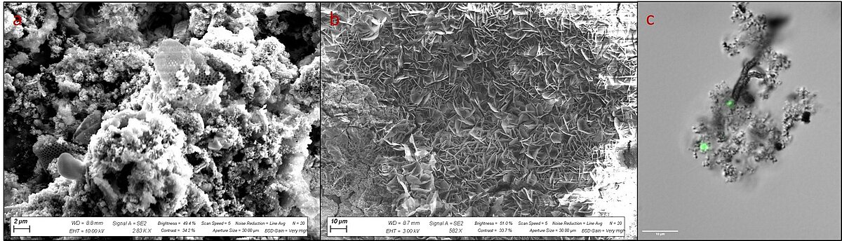 [Translate to English:] Mikroskopaufnahmen