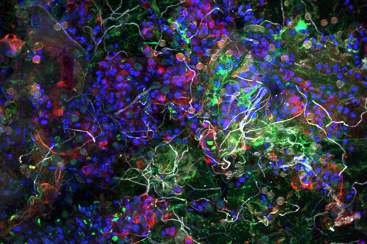 Aufnahme der Plastisphäre