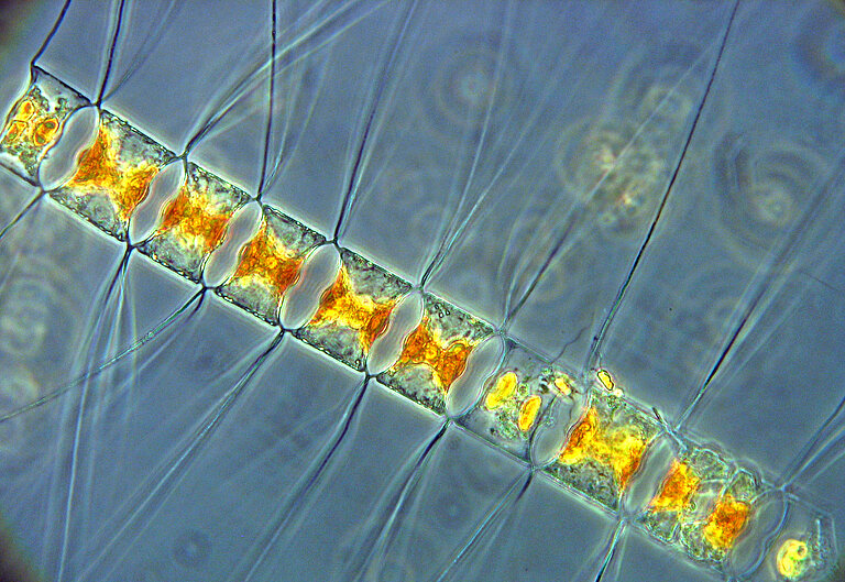 Diatomee Chaetoceros diadema