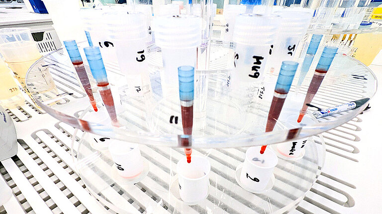 Laboranalyse von vulkanischem Gestein.