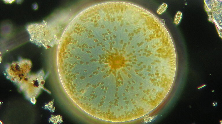 A unicellular plant under the microscope