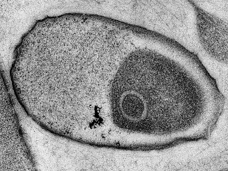 Transmission electron microscope image of an unknown bacterium that lives exclusively in marine sponges. Sponge symbionts cannot yet be cultivated and can only be given a provisional name according to the current codex. Photo: Dr. Martin Jahn (GEOMAR)