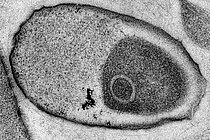 Transmissions-Elektronenmikroskopische Aufnahme eines unbekannten Bakteriums, welches ausschließlich in Meeresschwämmen lebt. Schwammsymbionten sind bisher nicht kultivierbar und können nach dem bisherigen Kodex nur mit einem vorläufigen Namen versehen werden. Foto: Dr. Martin Jahn (GEOMAR)