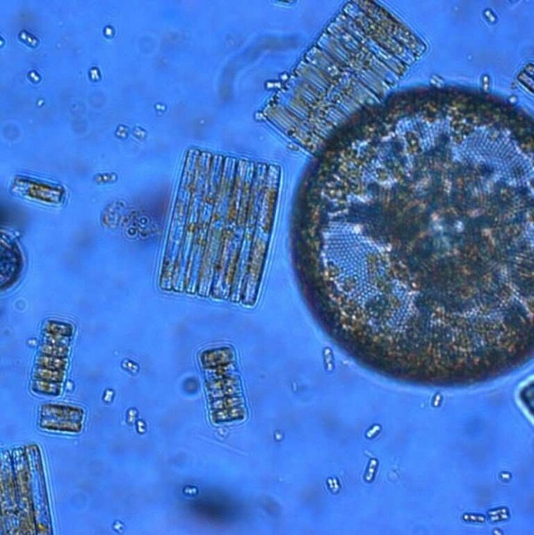 Phytoplankton aus dem Südlichen Ozean. Foto: Jeff McQuaid.