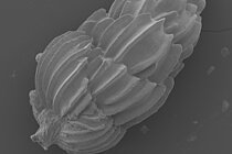 Electron-micrograph of Uvigerina peregrina