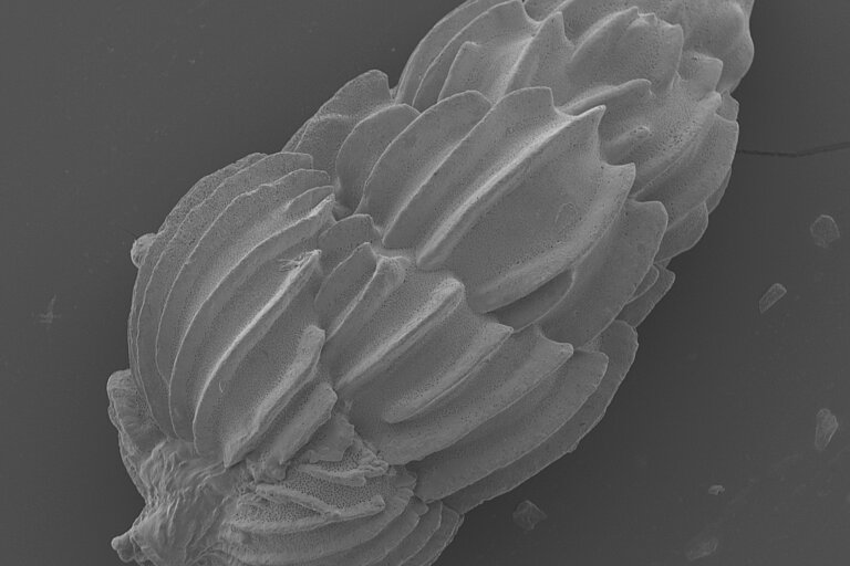 Elektronenmikroskopaufnahme von Uvigerina peregrina