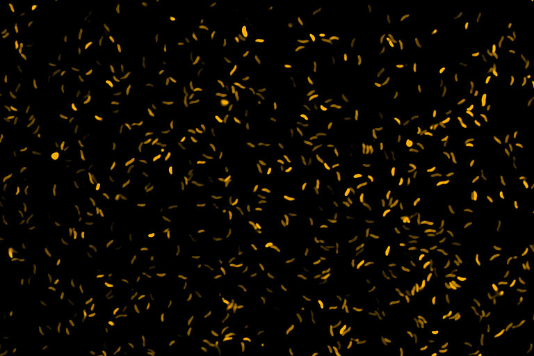 [Translate to English:] Kleine orangefarbene Erreger vor schwarzem Hintergrund