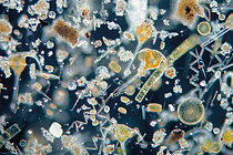 Microalgae under the microscope, against a black background, are small rod-shaped, spherical and spiral white and yellow structures.