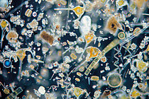 Mikroalgen unter dem Mikroskop, vor schwrzem Hintergrund sind kleine stäbchenförmige, kugelige und spiralige weiße und gelbe Strukturen