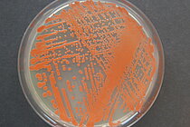 Pure culture of the red yeast Rhodotorula mucilaginosa isolated from deep-sea sediment samples of the Mid-Atlantic Ridge. Photo: L. Büdenbender, GEOMAR.